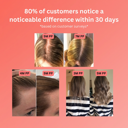 MadeForMomma Scalp Serum